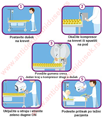 Uputstvo za upotrebu antidekubitnog dušeka