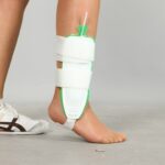 Ortoza za stabilizaciju skocnog zgloba